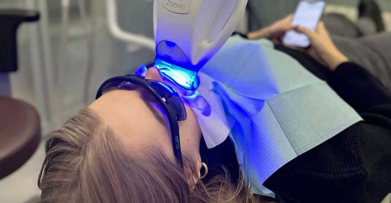 Zoom Teeth Whitening
