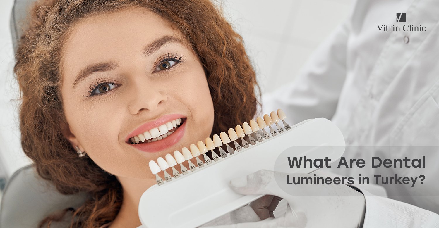 dental Lumineers