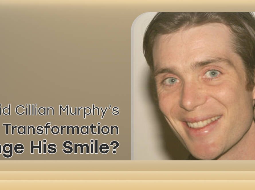 Cillian Murphy Teeth