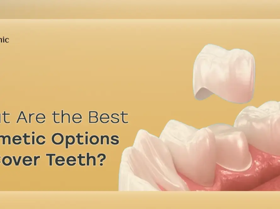 Cosmetic options to cover teeth