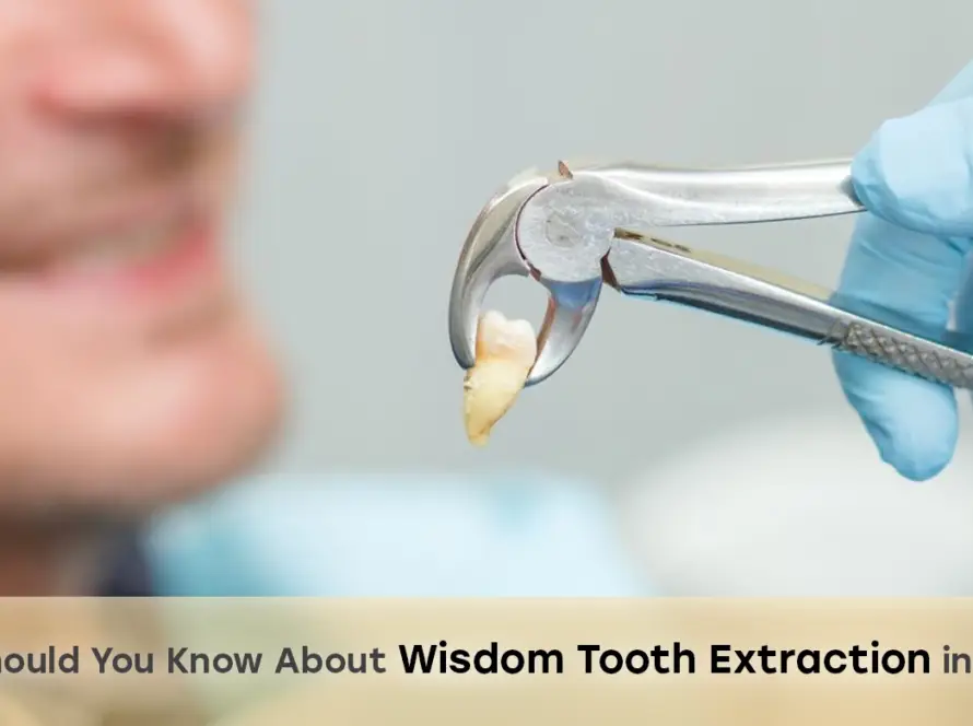 Wisdom tooth extraction