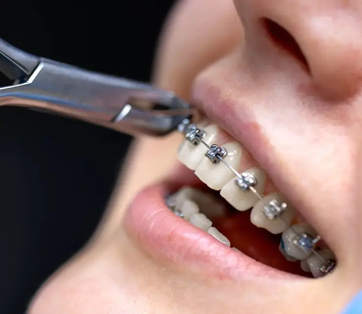Benefits-of-Orthodontic-Treatment-Copy (1) copy Benefits-of-Orthodontic-Treatment-Copy (1) copy