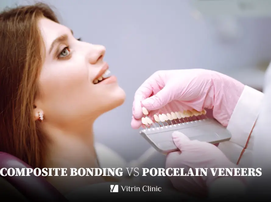 Composite vs Porcelain Veneers
