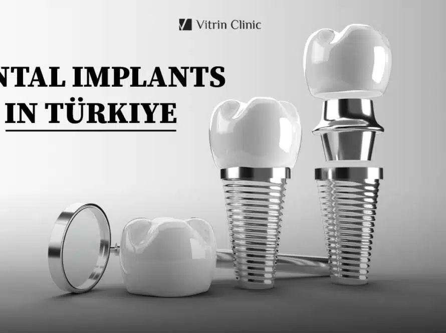Dental Implants in Turkey