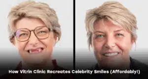 How Vitrin Clinic Recreates Celebrity Smiles (Affordably!)
