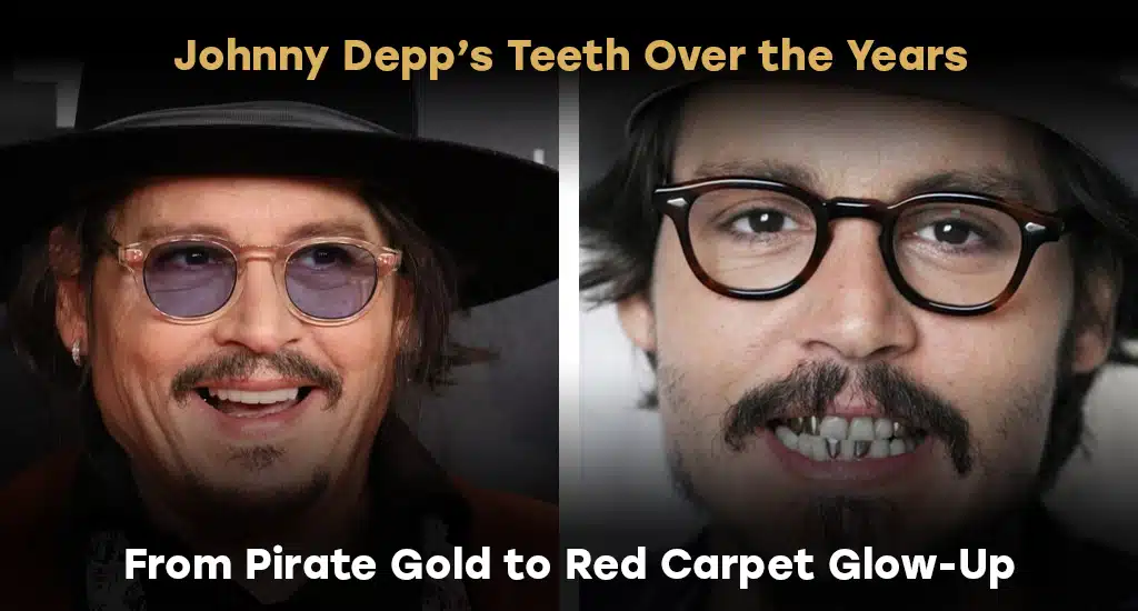 Johnny Depp’s Teeth Over the Years