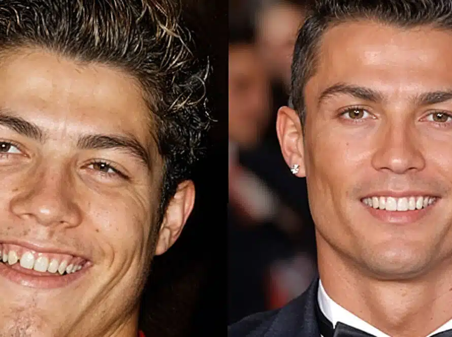 Want a Hollywood Smile Like Cristiano Ronaldo Say Siuuuuu! to Vitrin Clinic’s Makeover Magic at Istanbul