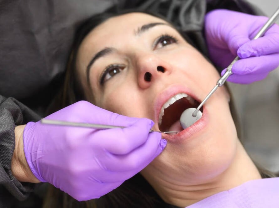 Dental Crown Repair Cost in Turkey 2025