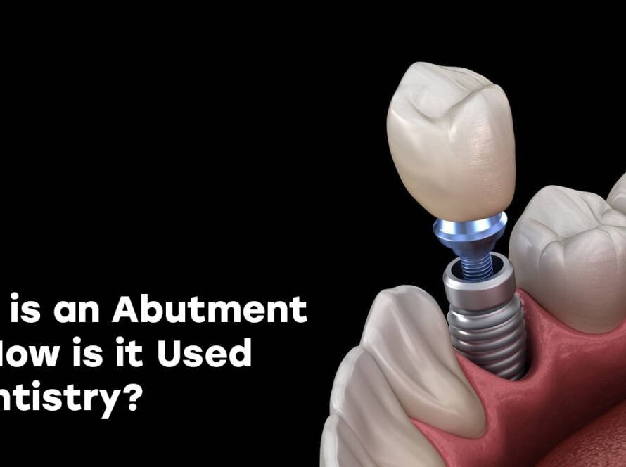 Abutments