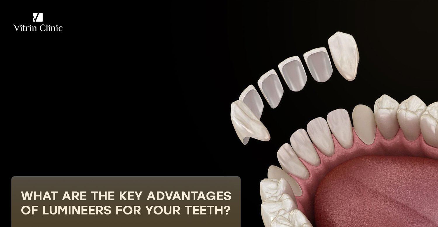 Advantages of lumineers