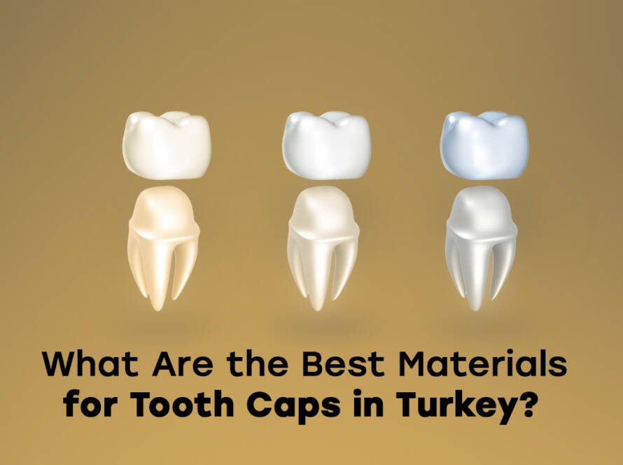 Best materials for tooth caps