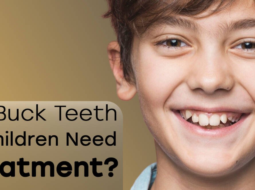 Buck teeth in children