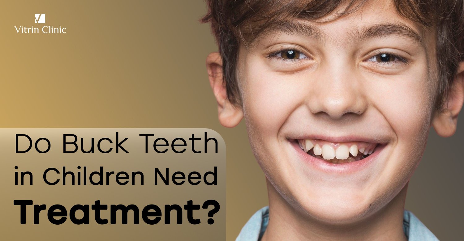 Buck teeth in children