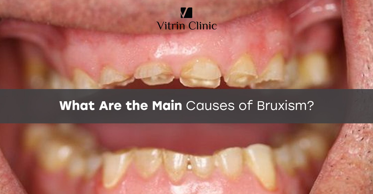 Causes of bruxism