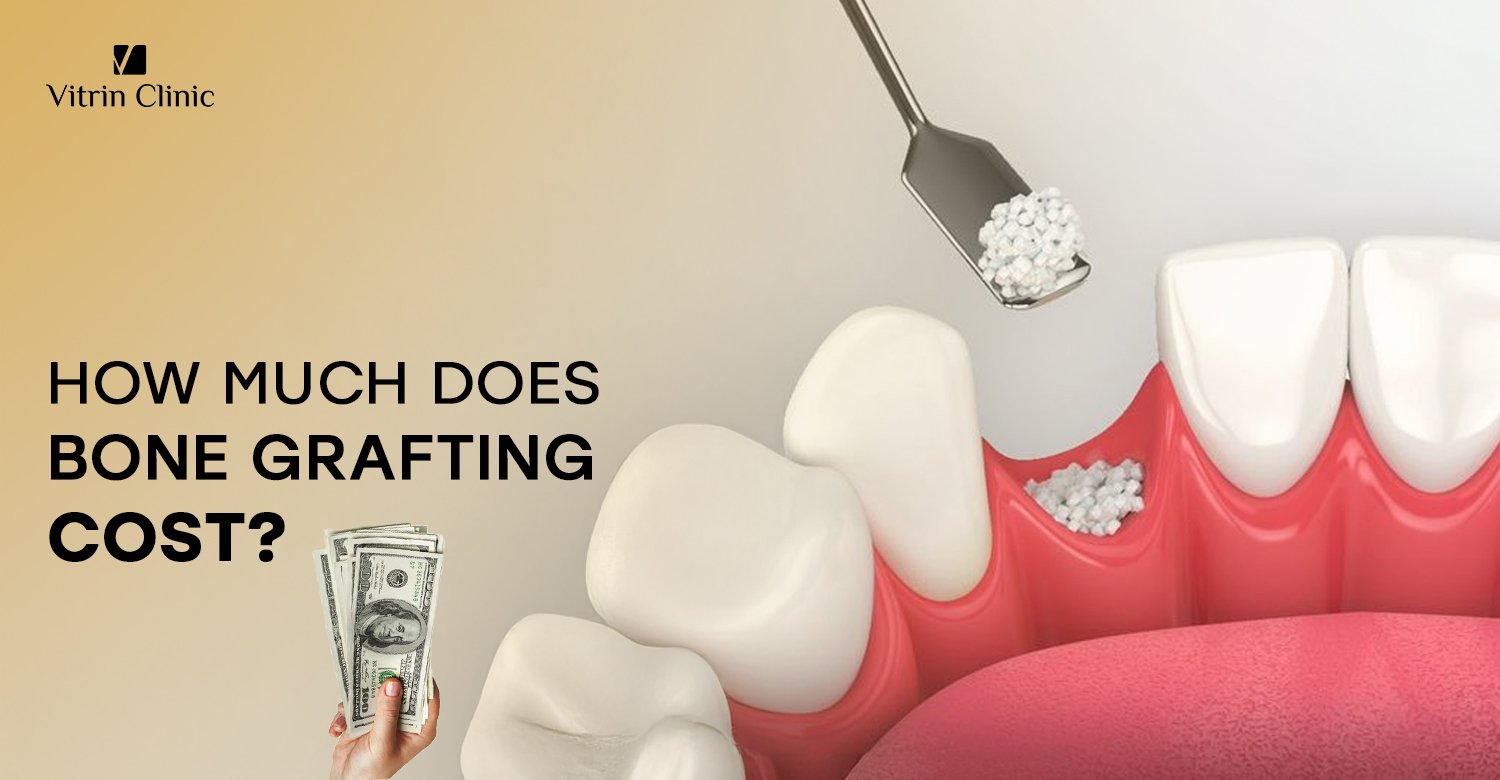 Cost of bone grafting