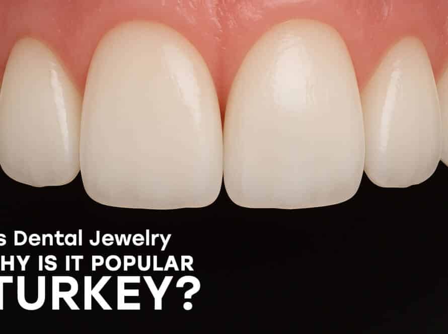 Dental jewelry