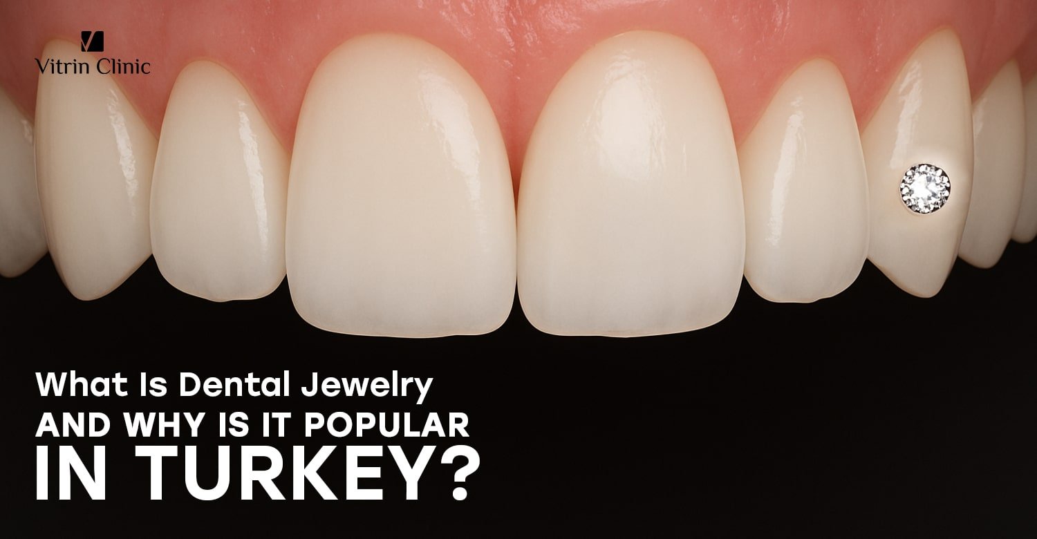 Dental jewelry