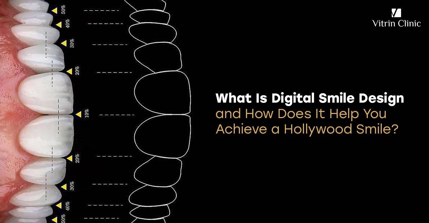Digital Smile Design