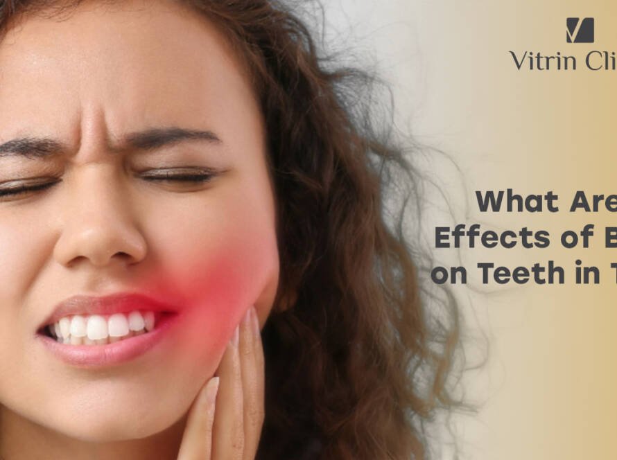 Effects of bruxism on teeth