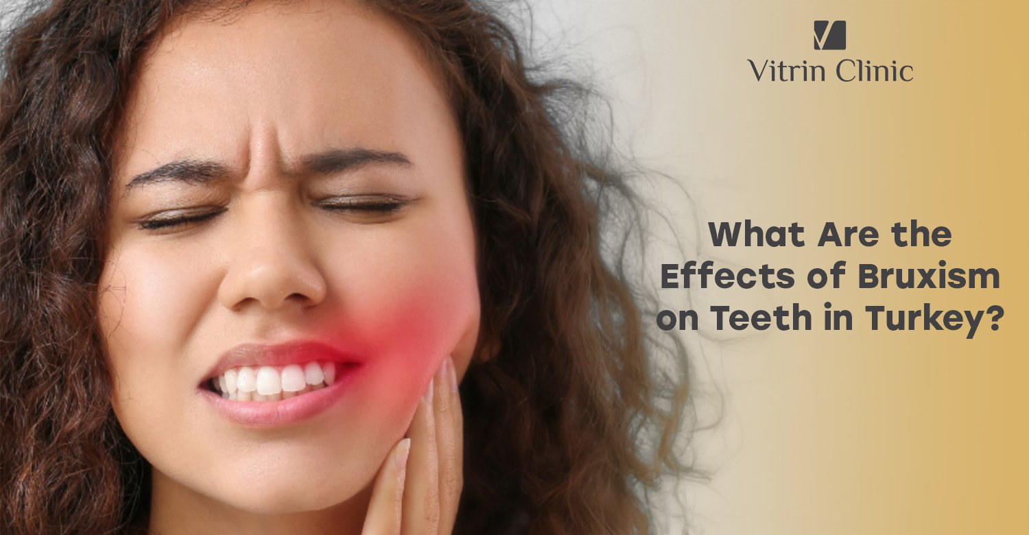 Effects of bruxism on teeth