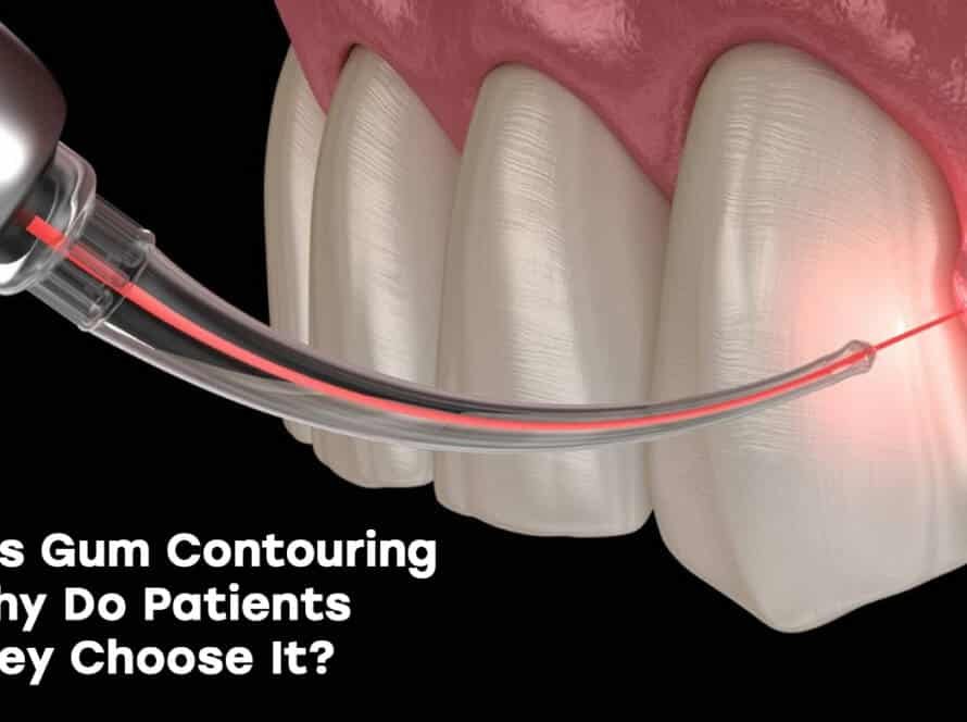 Gum contouring