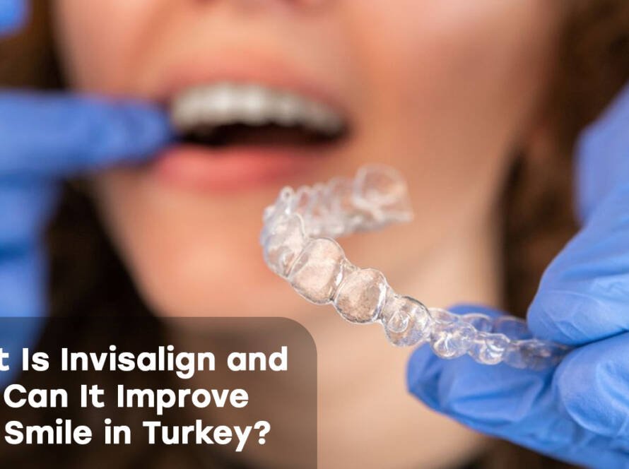Invisalign