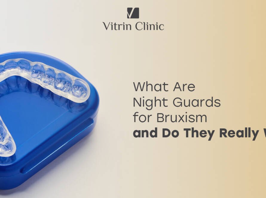 Night guards for bruxism