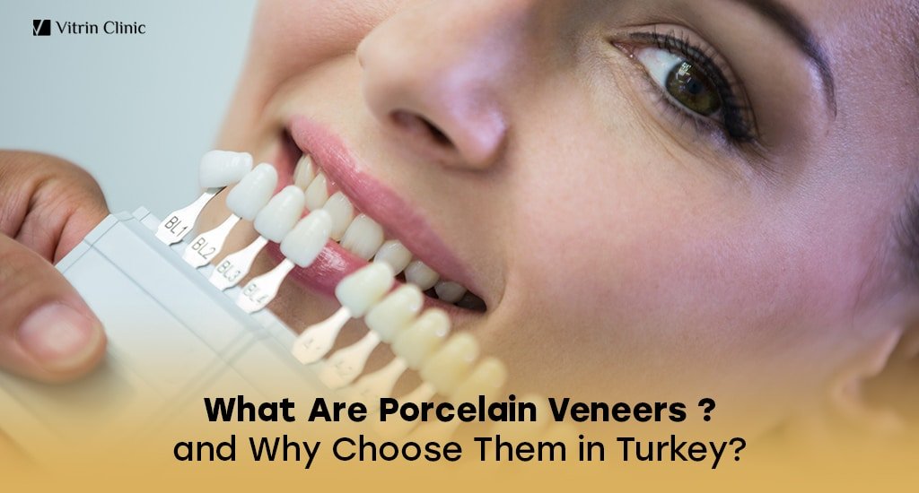 -Porcelain veneers