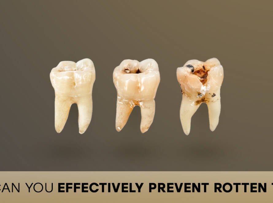 Preventing rotten teeth
