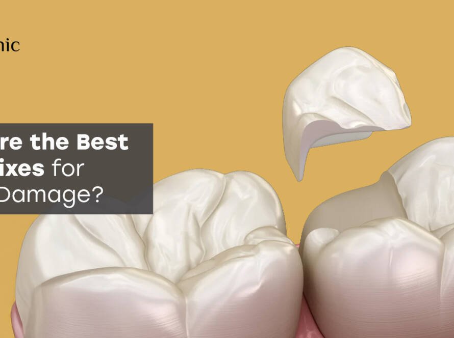 Quick Fixes for Dental Damage