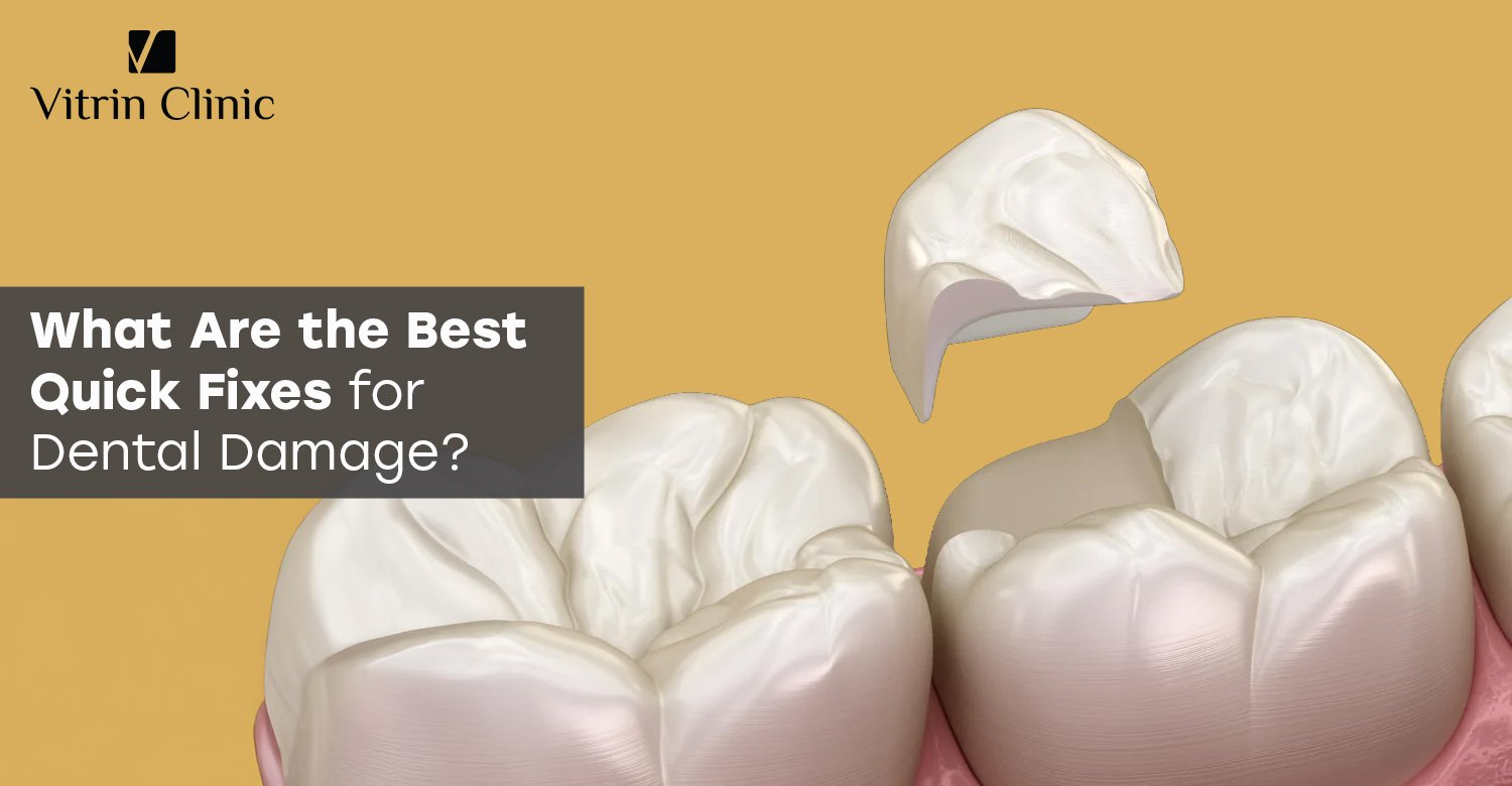 Quick Fixes for Dental Damage