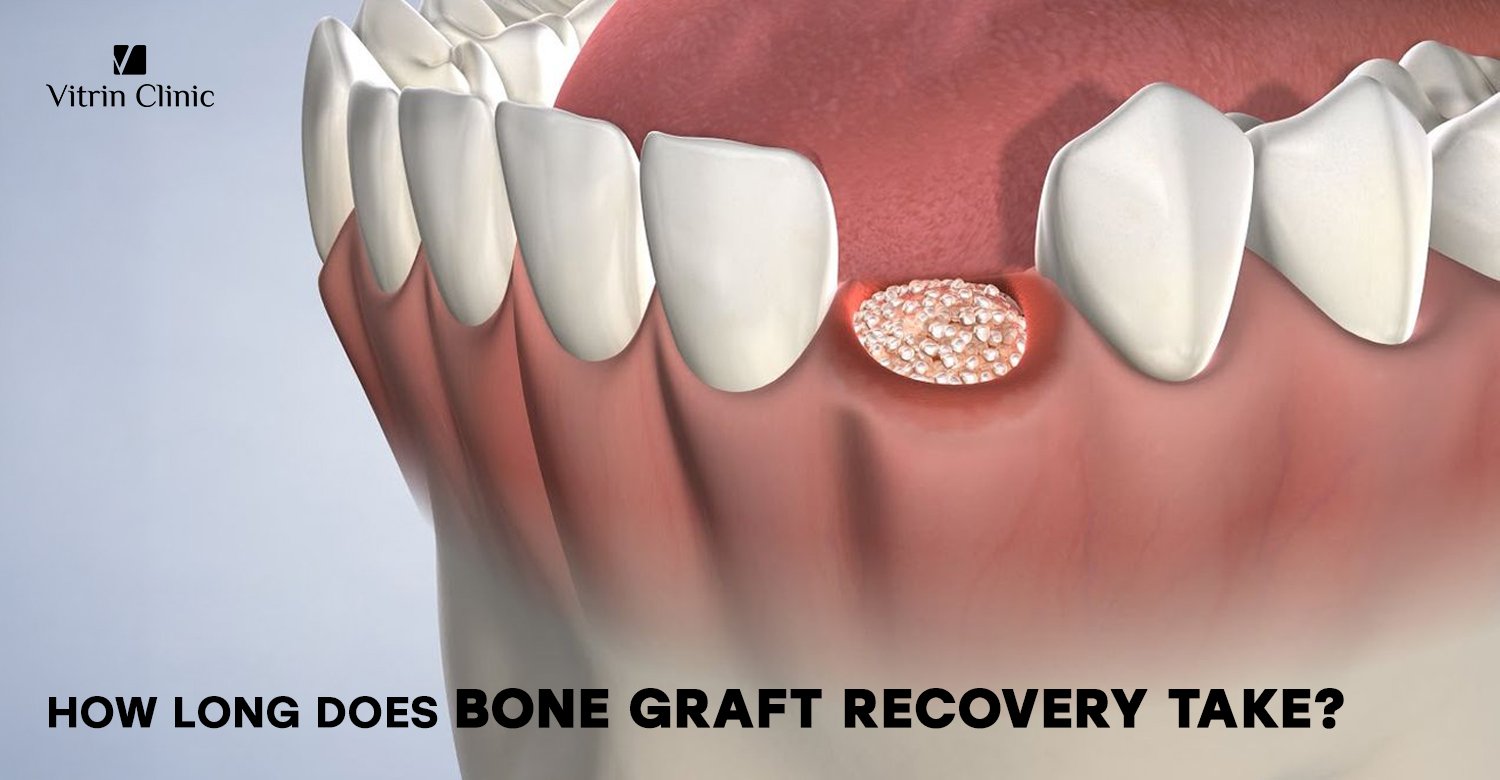 Recovery after bone graft