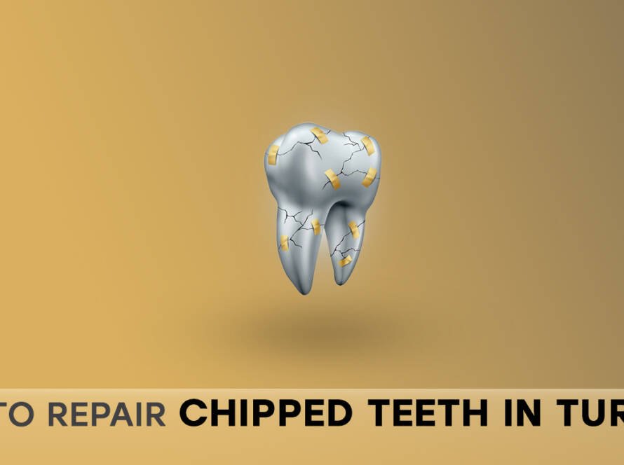 Repairing chipped teeth