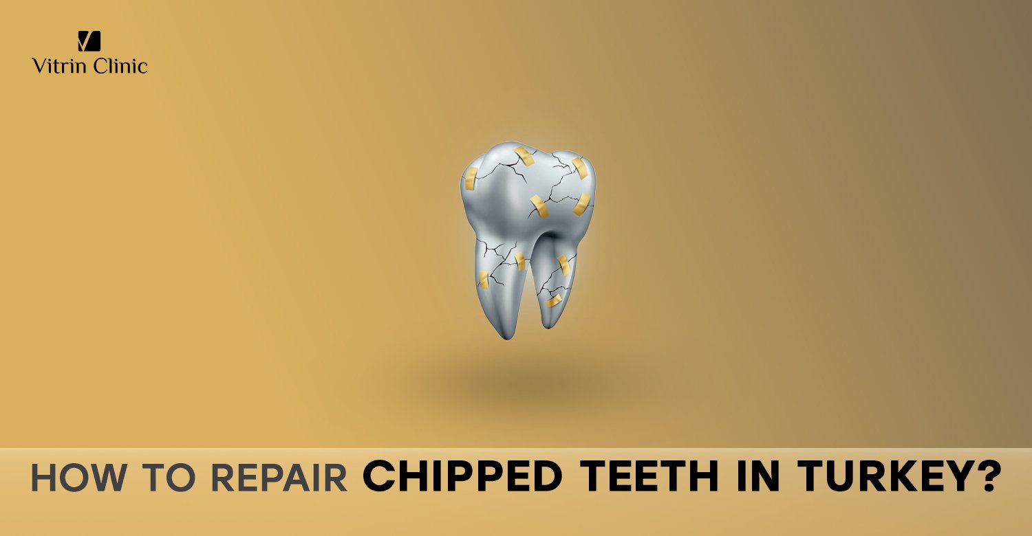 Repairing chipped teeth