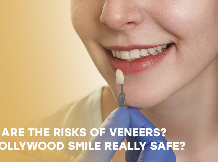 Risks of Veneers