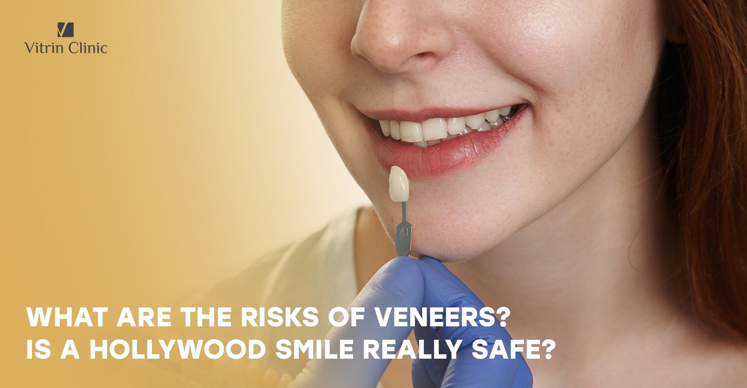 Risks of Veneers