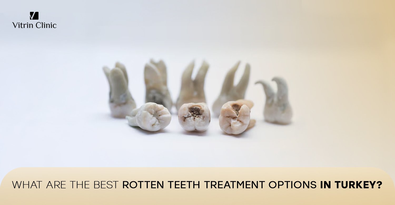 Rotten teeth treatment options