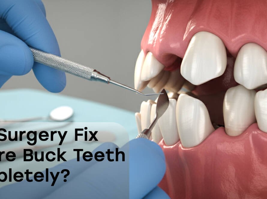 Surgery Fix Severe Buck Teeth