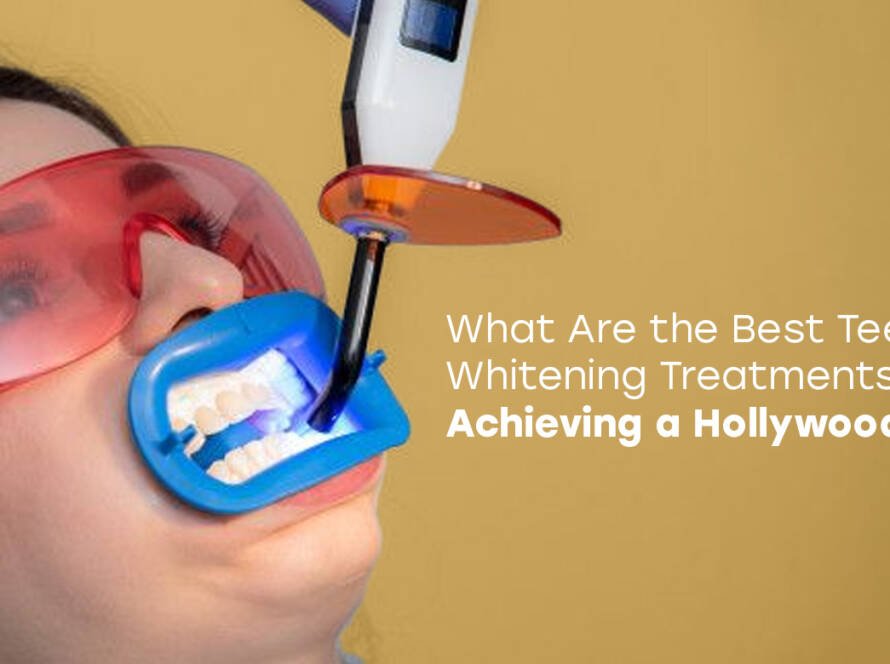 Teeth Whitening Treatments