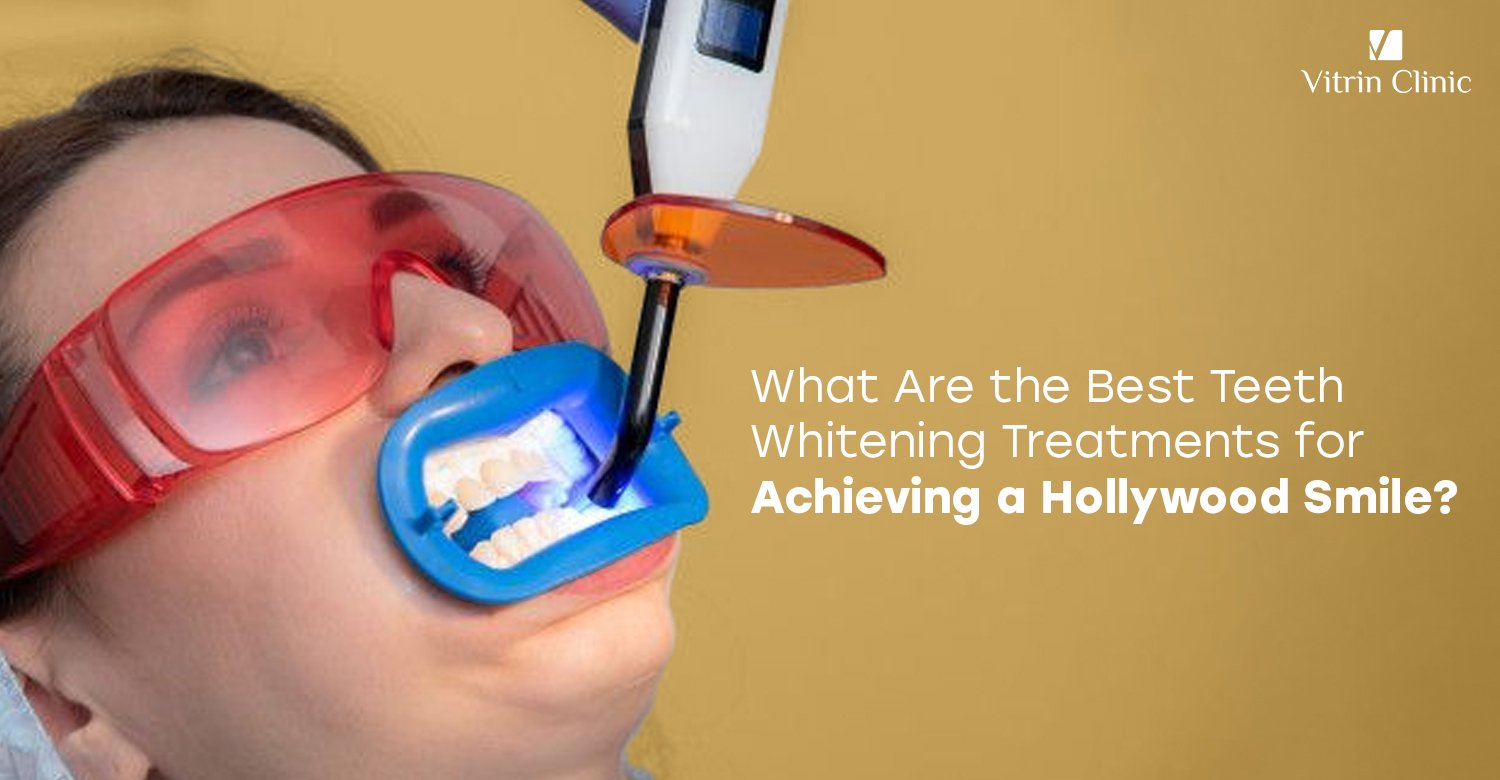 Teeth Whitening Treatments