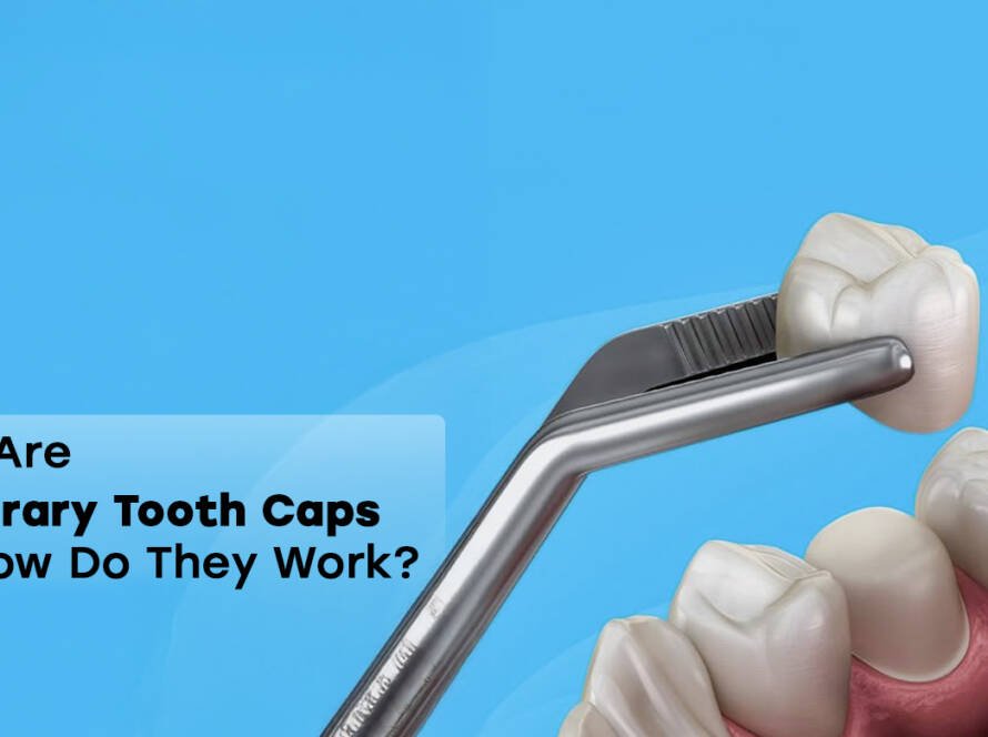 Temporary tooth caps