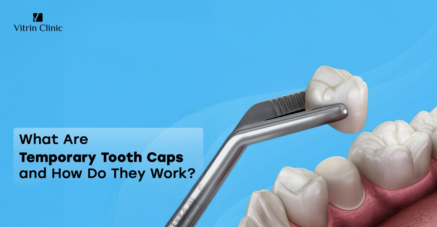 Temporary tooth caps