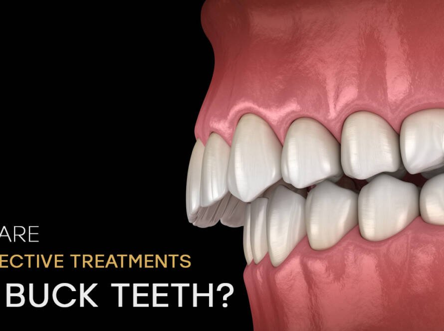 Treatments for buck teeth