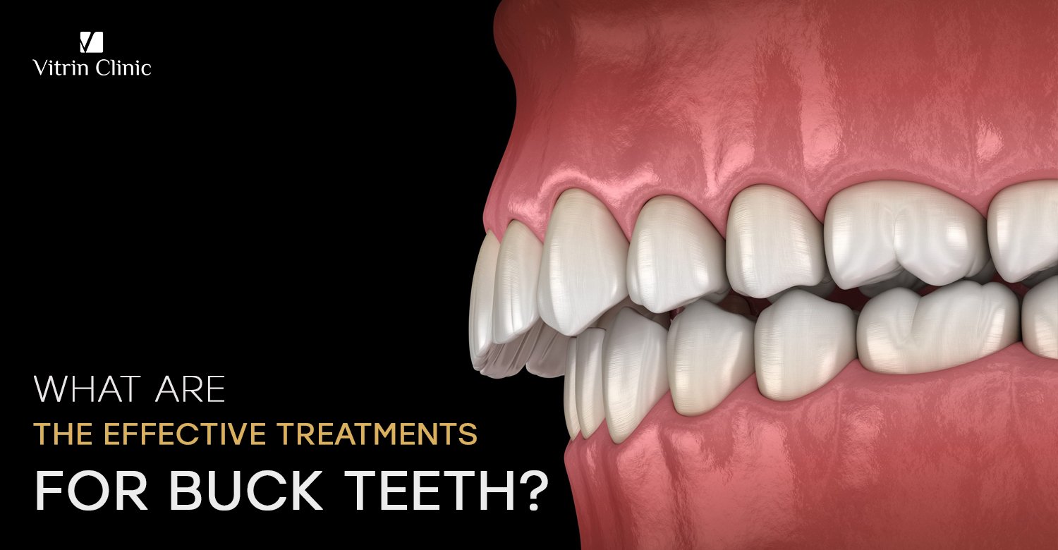 Treatments for buck teeth