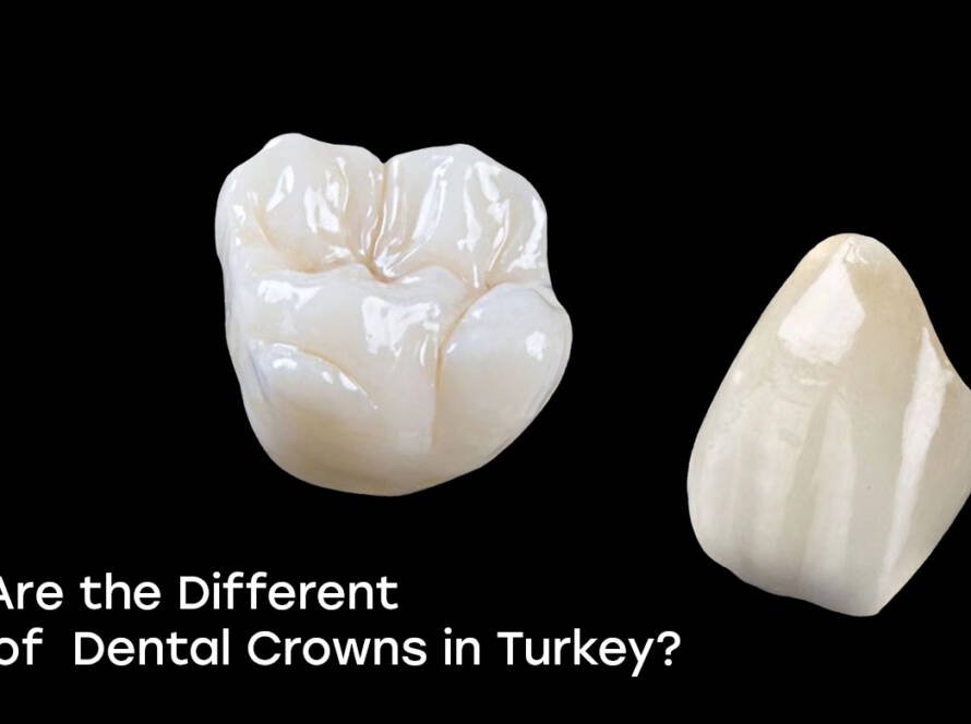 Types of dental crowns