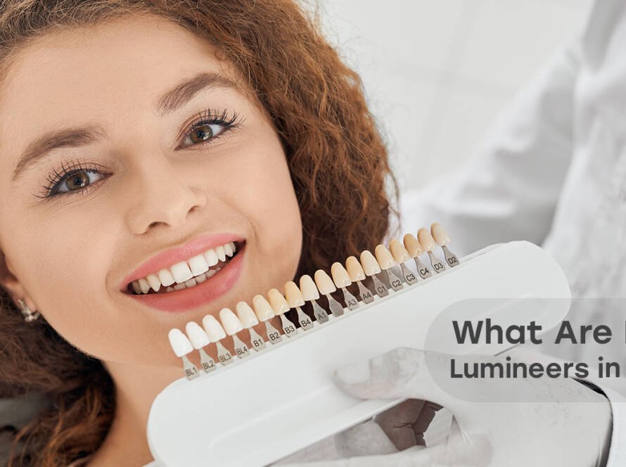 dental Lumineers