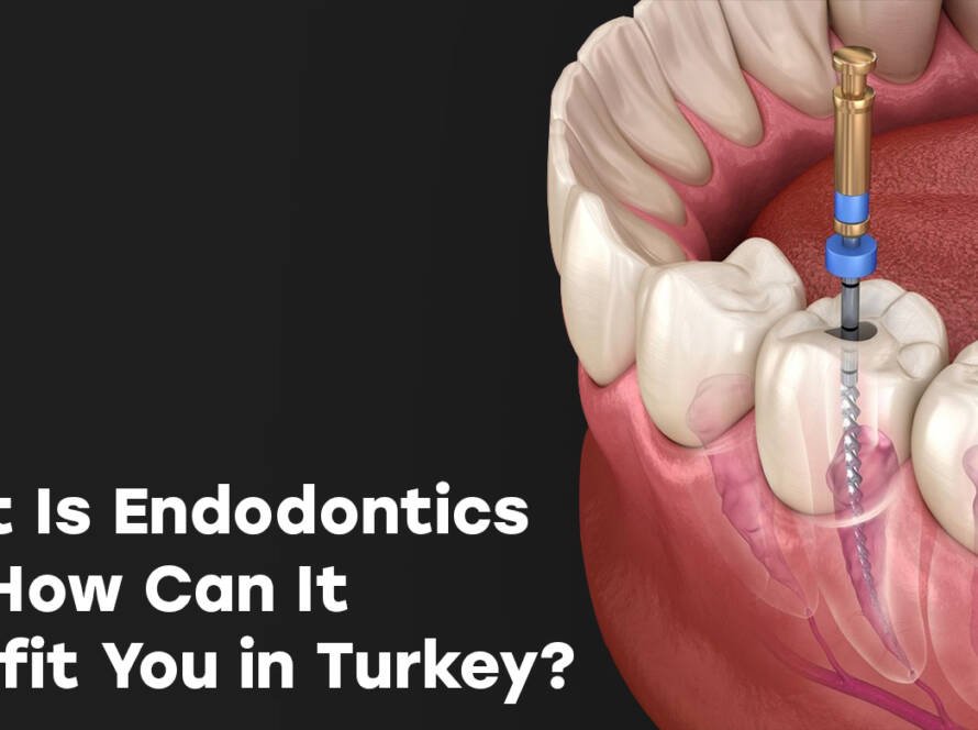 endodontics