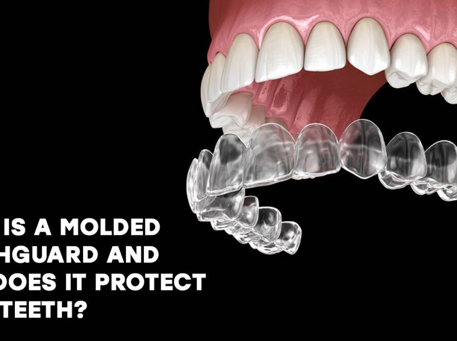 molded mouthguard