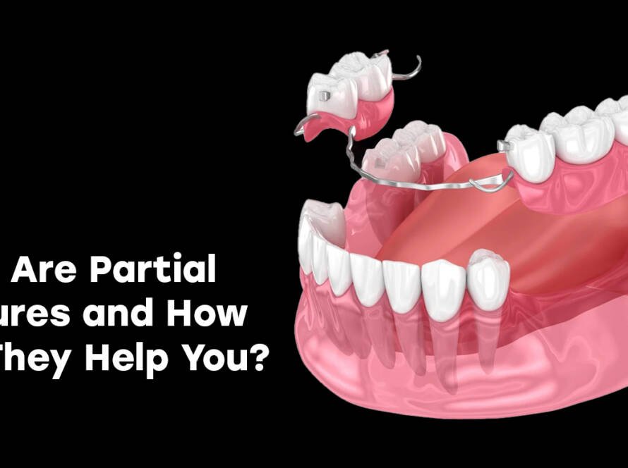 partial dentures