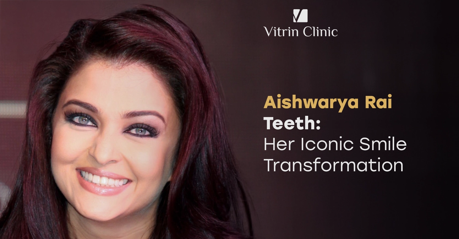 Aishwarya Rai Teeth Before and After: Her Iconic Smile Transformation 2026
